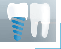 VitalEurope dental implants