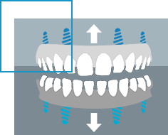 VitalEurope dentures